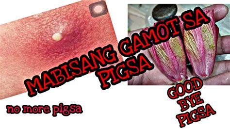 mabisang gamot sa pangangati ng pepe|Mabisang gamot sa Pigsa sa Pepe .